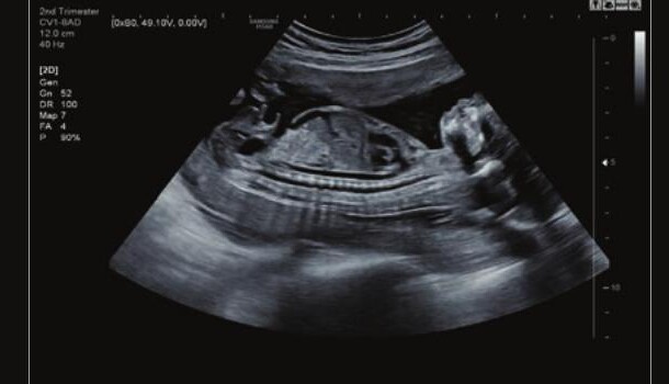 Samsung HS60 – Diagnostic Ultrasound System - Image 7
