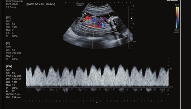 Samsung HS60 – Diagnostic Ultrasound System - Image 8