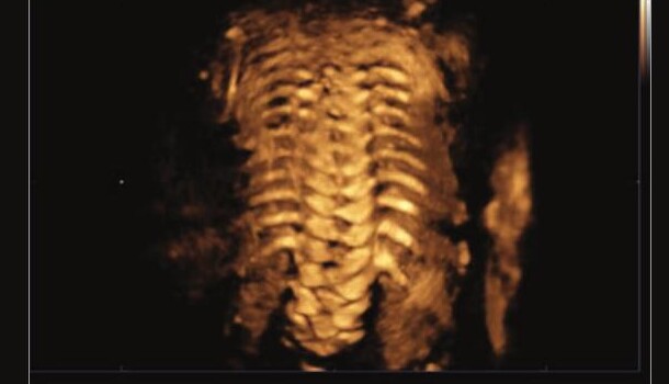 Samsung HS60 – Diagnostic Ultrasound System - Image 9