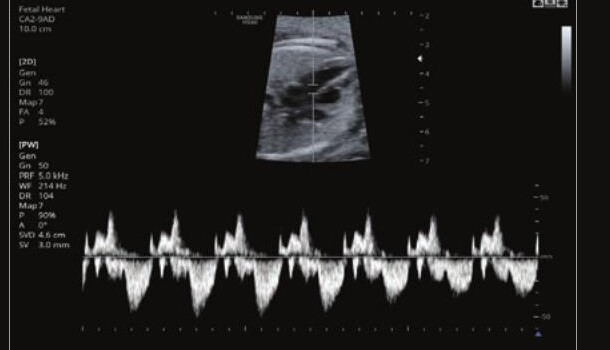 Samsung HS60 – Diagnostic Ultrasound System - Image 10