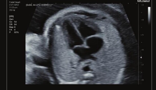 Samsung HS60 – Diagnostic Ultrasound System - Image 11