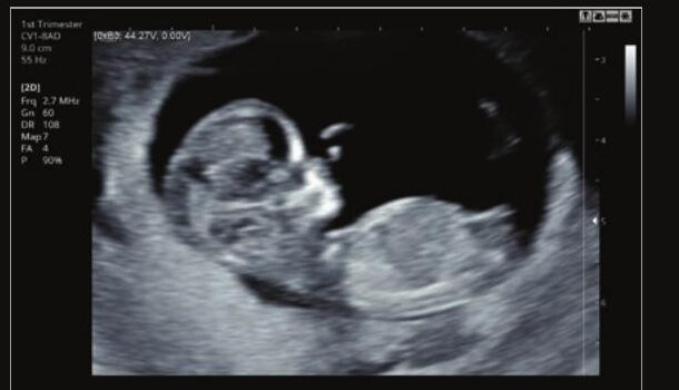 Samsung HS60 – Diagnostic Ultrasound System - Image 12