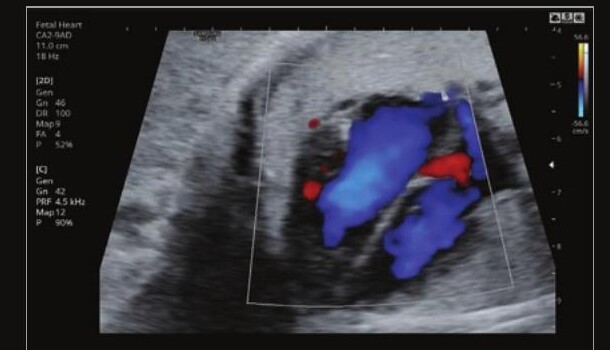 Samsung HS60 – Diagnostic Ultrasound System - Image 13