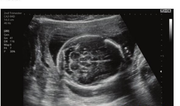 Samsung HS60 – Diagnostic Ultrasound System - Image 14