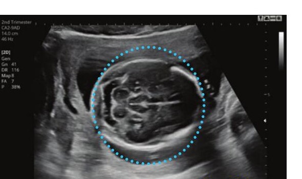 Samsung HS60 – Diagnostic Ultrasound System - Image 15