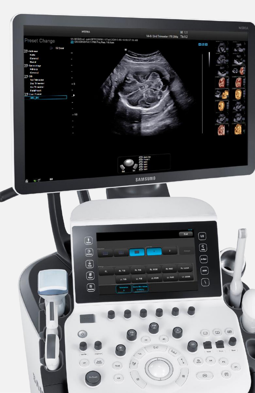 Samsung WS80A with Elite – Diagnostic Ultrasound System
