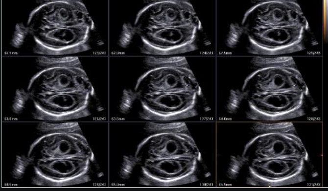 Samsung WS80A with Elite – Diagnostic Ultrasound System - Image 4