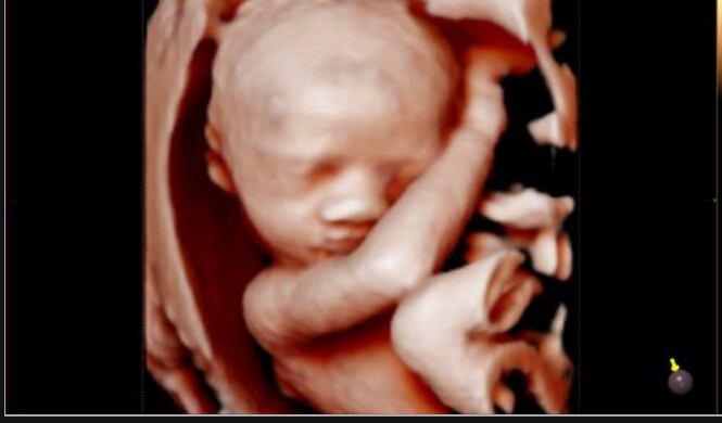 Samsung WS80A with Elite – Diagnostic Ultrasound System - Image 5