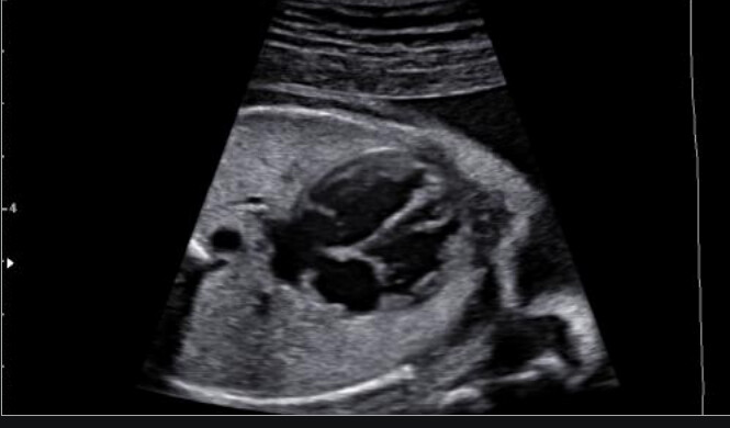 Samsung WS80A with Elite – Diagnostic Ultrasound System - Image 6