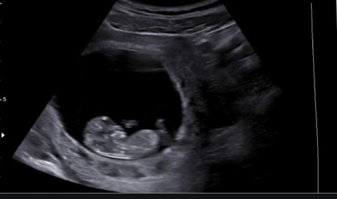 Samsung WS80A with Elite – Diagnostic Ultrasound System - Image 7