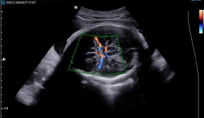 Samsung WS80A with Elite – Diagnostic Ultrasound System - Image 8