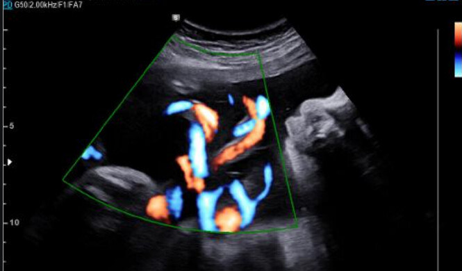 Samsung WS80A with Elite – Diagnostic Ultrasound System - Image 9