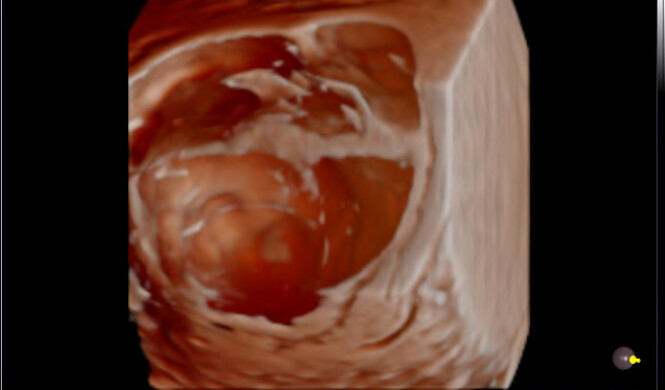Samsung WS80A with Elite – Diagnostic Ultrasound System - Image 10