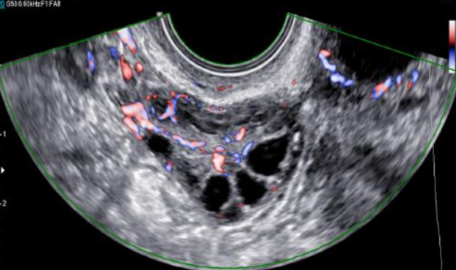 Samsung WS80A with Elite – Diagnostic Ultrasound System - Image 11
