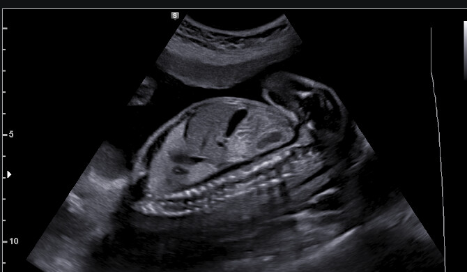 Samsung WS80A with Elite – Diagnostic Ultrasound System - Image 12