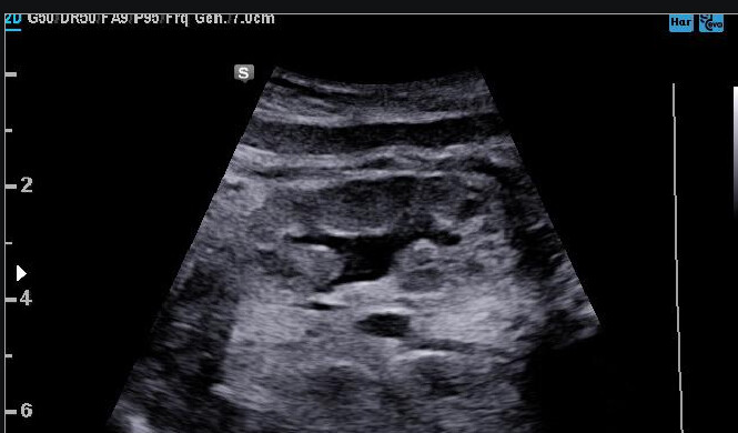 Samsung WS80A with Elite – Diagnostic Ultrasound System - Image 13