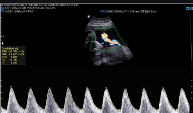 Samsung WS80A with Elite – Diagnostic Ultrasound System - Image 14