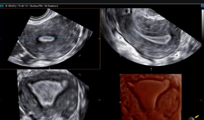 Samsung WS80A with Elite – Diagnostic Ultrasound System - Image 15