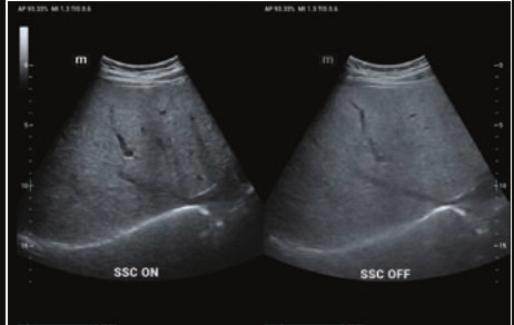 Mindray Resona I9 – Ultrasound System - Image 6