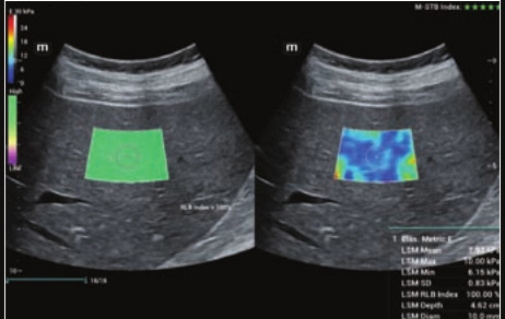 Mindray Resona I9 – Ultrasound System - Image 7