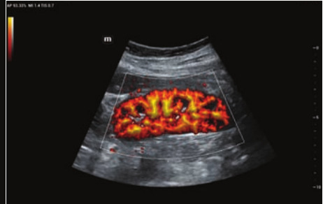 Mindray Resona I9 – Ultrasound System - Image 8