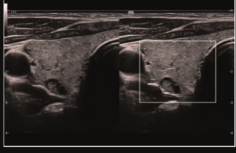 Mindray Resona I9 – Ultrasound System - Image 9