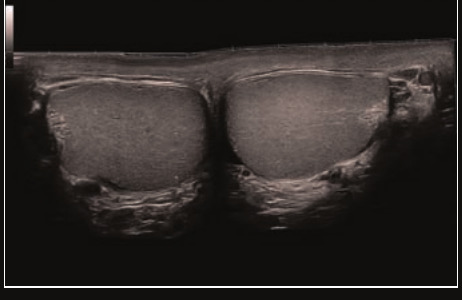 Mindray Resona I9 – Ultrasound System - Image 10