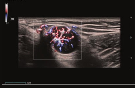 Mindray Resona I9 – Ultrasound System - Image 11
