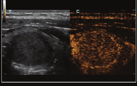 Mindray Resona I9 – Ultrasound System - Image 12