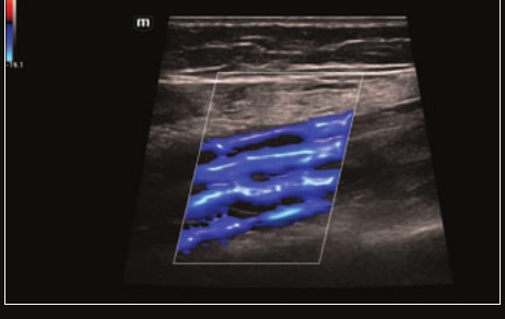 Mindray Resona I9 – Ultrasound System - Image 13