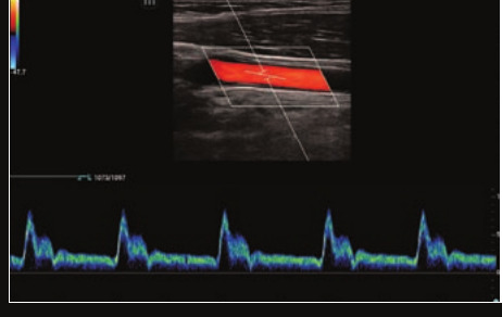 Mindray Resona I9 – Ultrasound System - Image 14