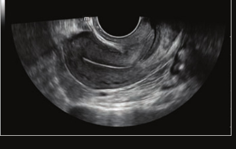 Mindray Resona I9 – Ultrasound System - Image 15
