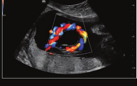 Mindray Resona I9 – Ultrasound System - Image 16