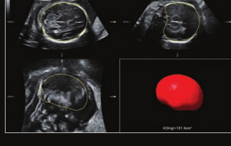 Mindray Resona I9 – Ultrasound System - Image 17