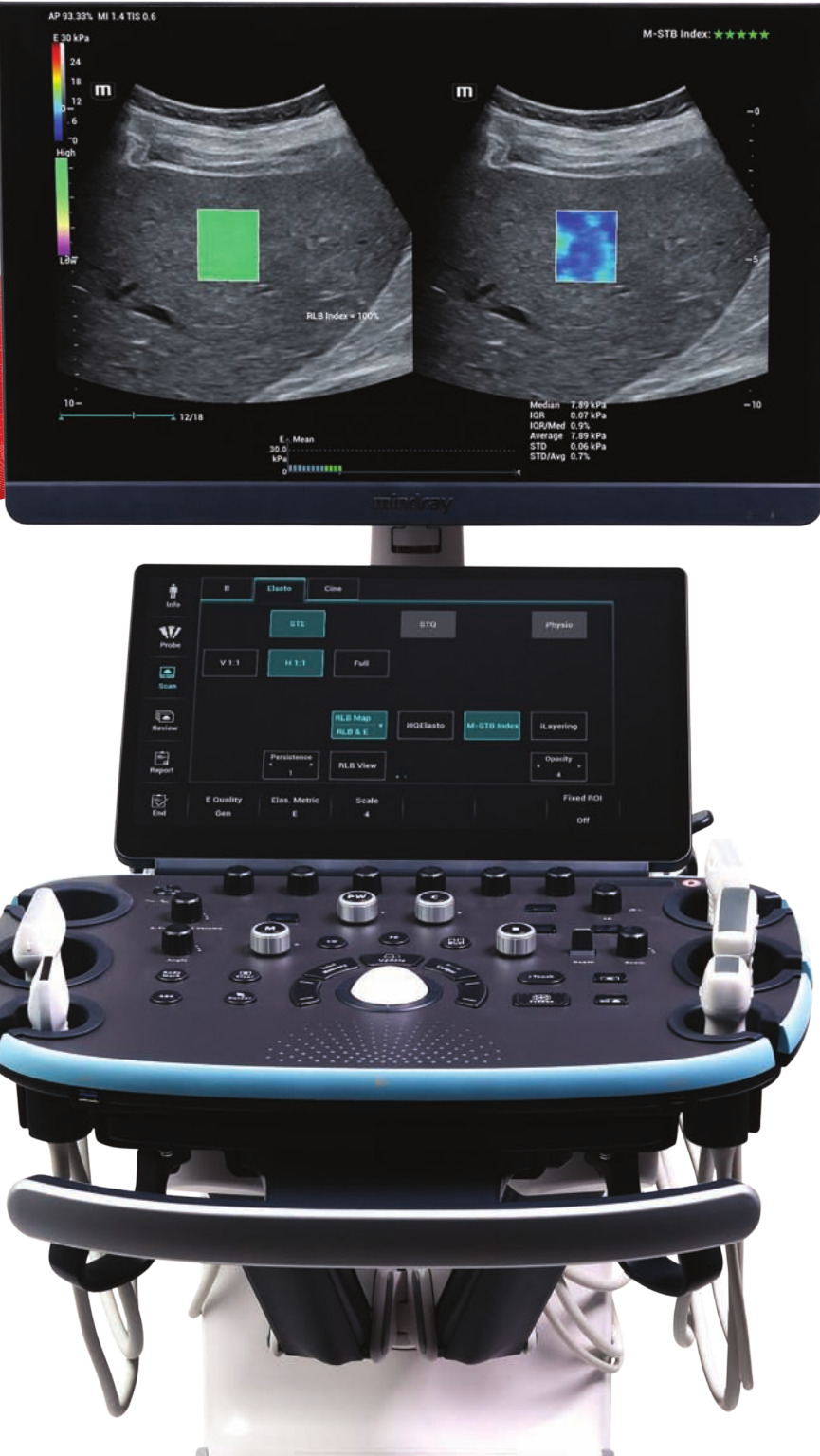 Mindray Resona I9 – Ultrasound System