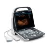 Mindray DP-10 - Diagnostic Ultrasound System
