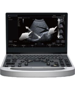 Mindray MU7 – Diagnostic Ultrasound System